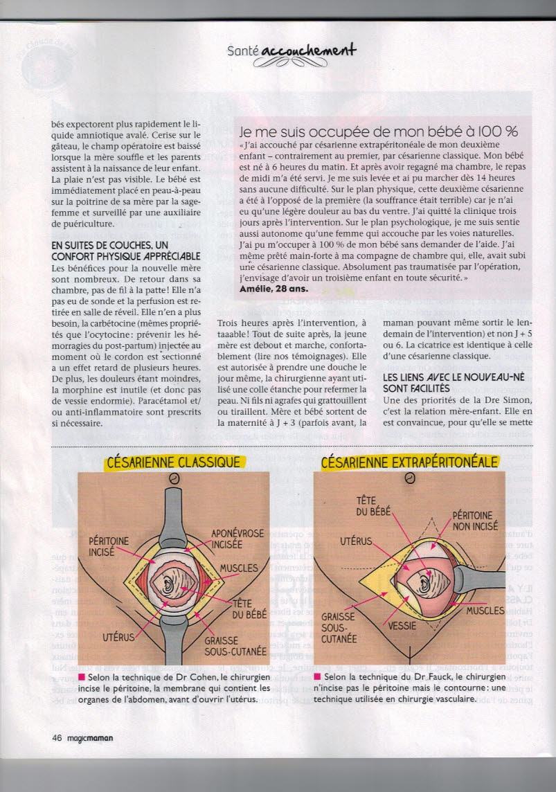 La césarienne extrapéritonéale, bientôt pour toutes ?